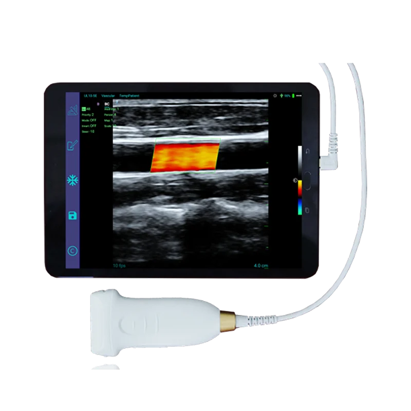 Amaın Tıbbi malzemeler MagıQ MCUL10-5E el Renkli Doppler ve CE Sertifikası doğrusal prob ultrason