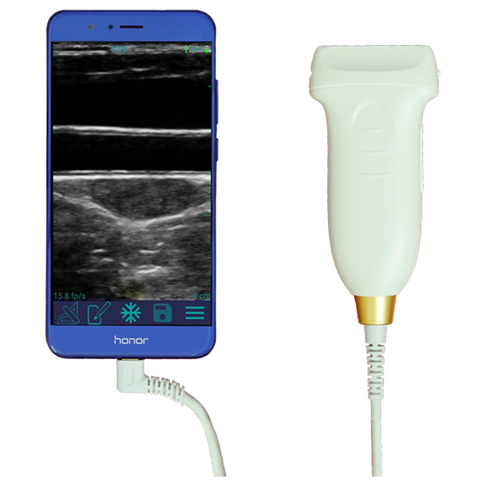Amaın Tıbbi malzemeler MagıQ MCUL10-5E el Renkli Doppler ve CE Sertifikası doğrusal prob ultrason