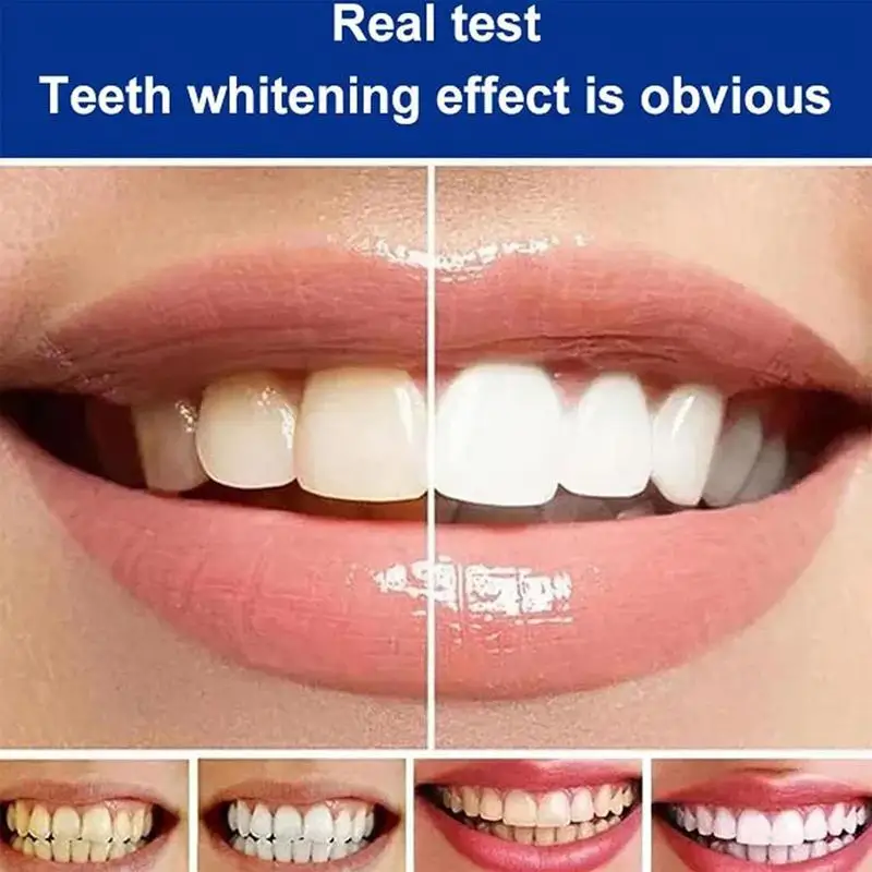 Diş Temizleme Diş Macunu Diş Beyaz Diş Macunu 100g Probiyotik Enzim Diş Macunu Diş Taze Nefes Sağlıklı Diş Etleri